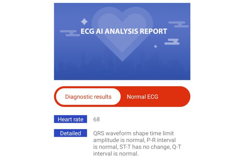 EKG