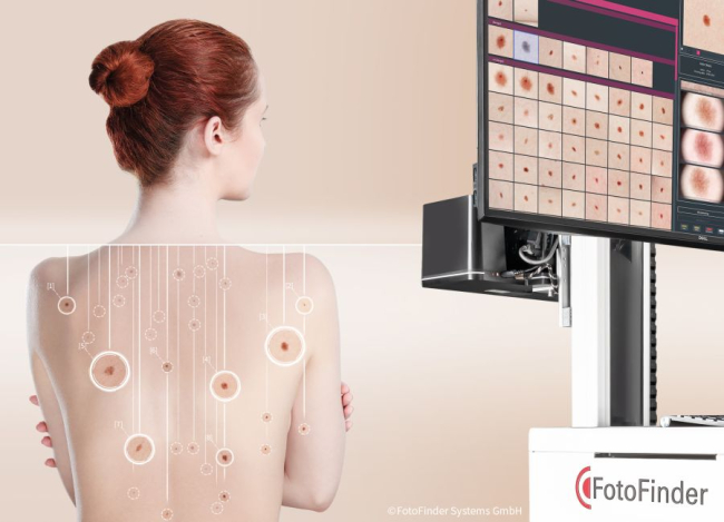 Fotofinder